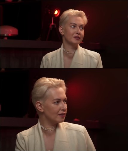 У Ярослави Кравченко помітили проблеми із щитовидкою