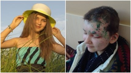 Тепер у Марини є страх перед дзеркалами і вікнами