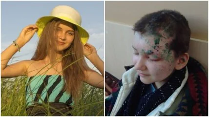 Тепер у Марини є страх перед дзеркалами і вікнами