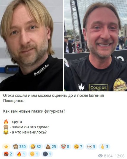 Євген Плющенко до та після пластики