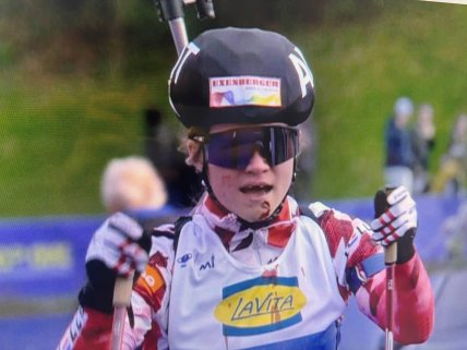 Лара Вагнер потеряла зубы