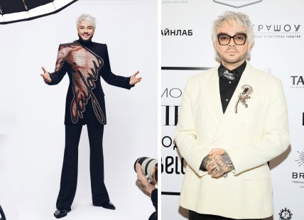 Киркоров операции фото