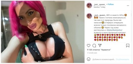 Анастасия Покрещук увеличила грудь