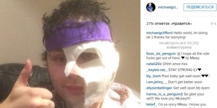 Музыкант загорелся во время концерта