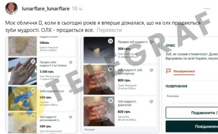 В Україні продають зуби мудрості