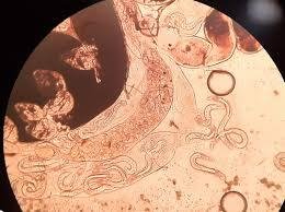 Дирофиляриоз под микроскопом