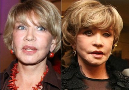 віра алентова пластика