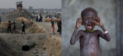 Фото голода в Судане