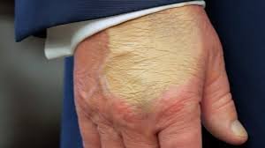 пляма на руці Трампа