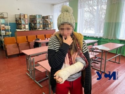 Перелом руки Одеська область