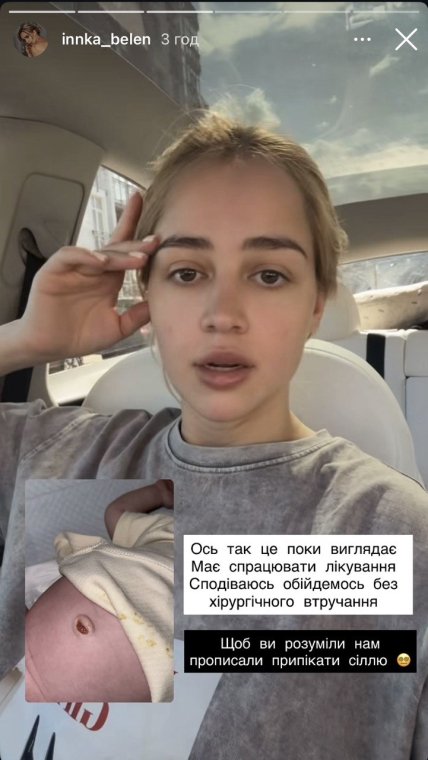 Инна Белень
