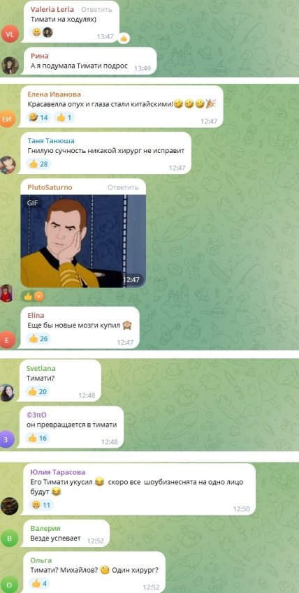 Филипп Киркоров после пластики