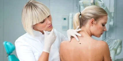 Что нужно делать, чтобы на теле не появлялись новые родинки