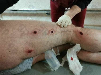 мужчину обстреляли