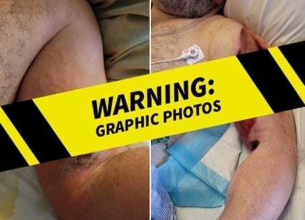 Мужчину укусил паук на съемках фильма Ржавчина