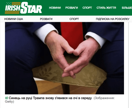 Синець Трампа