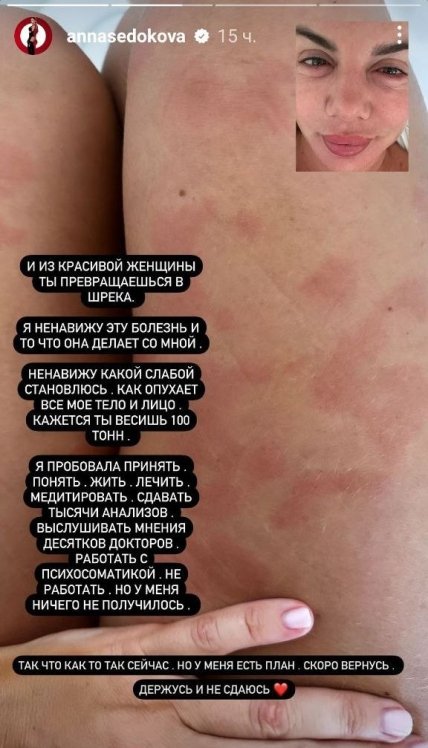 анна седокова