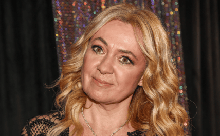 Яна Рудковская до пластики