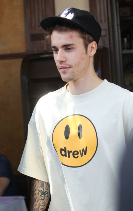 Джастин Бибер болезнь Лайма