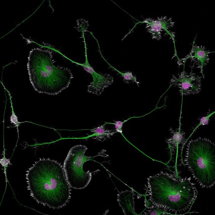 Яйця восьминога і не тільки: як конкурс Nikon Small World відкриває нові горизонти (фото)