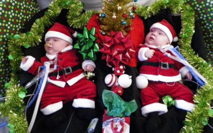 Врачи успешно разделили сиамских близнецов (ФОТО) - изображение №1