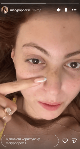 Маша Полякова показала последствия ДТП
