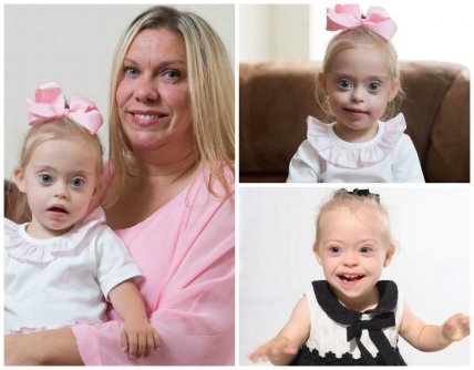 Двухлетняя девочка с синдромом Дауна стала моделью - изображение №1