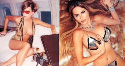 Меланія Трамп пластичні операції