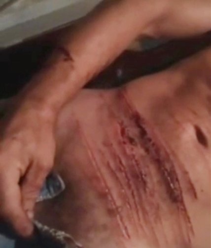 Мужчина прислал видео, где он порезал свои руки и живот