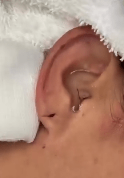 Тараканье в ухе женщины