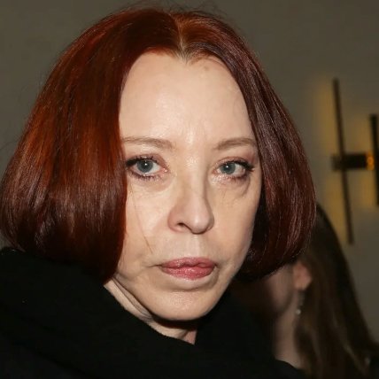 Анастасія Вертинська пластика