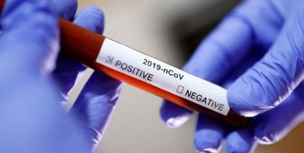 тест на коронавирус
