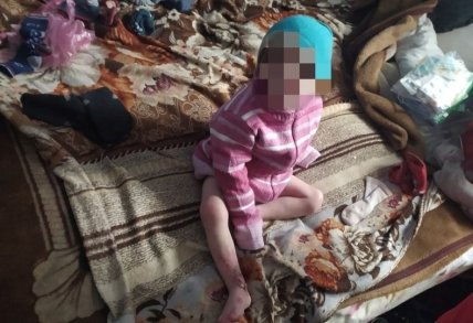 Мать не лечила ребенка