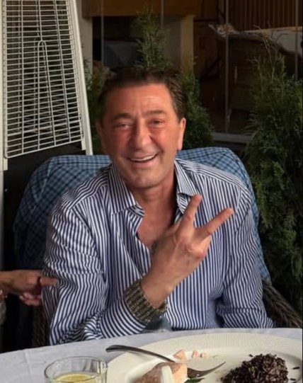 григорий лепс после пластики