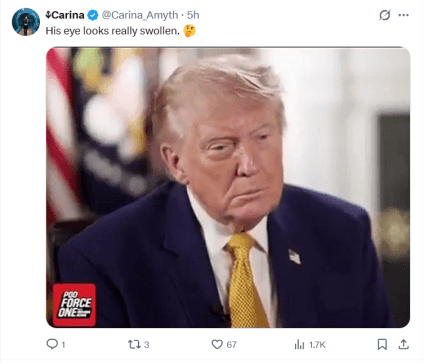 Трамп болезнь
