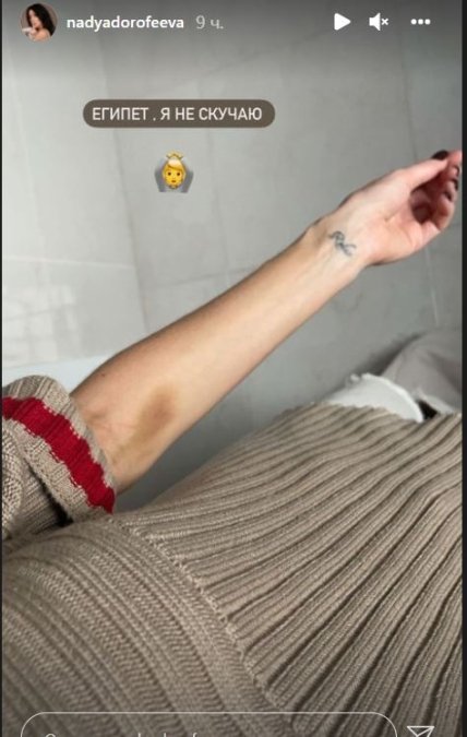 Рука Нади Дорофеевой