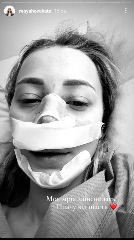 Катя Репяхова Павлик сделала ринопластику