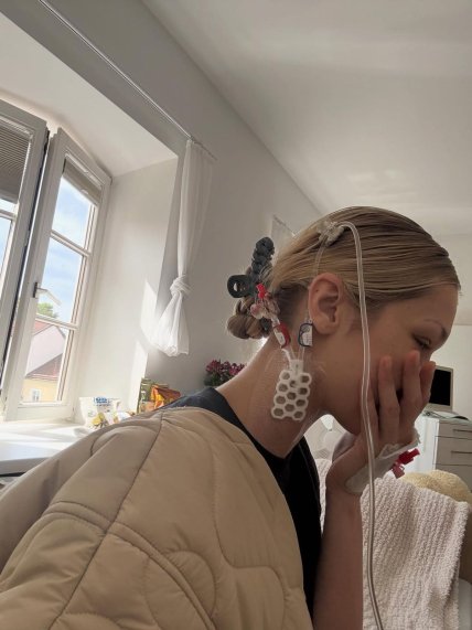 Белла Хадид болезнь Лайма