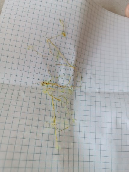 Женщина нашла глисты в пельменях из АТБ