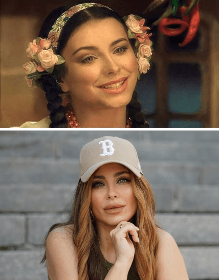 Лорак пластика