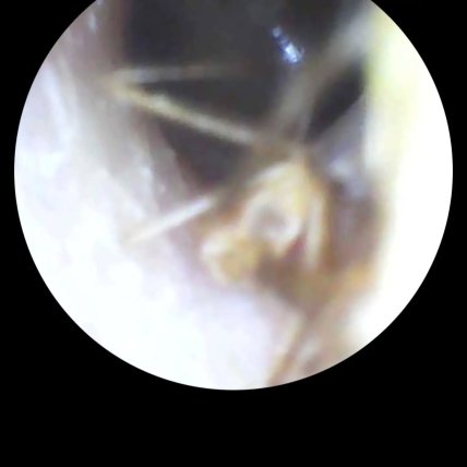 У пациентки в ухе обнаружили паука