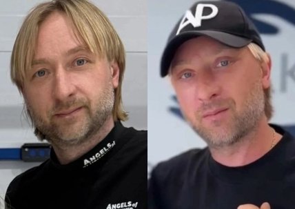 Плющенко пластика