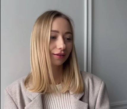 Катя Репяхова до ринопластики: фото