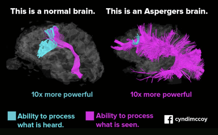 Як працює мозок за синдрома Аспергера