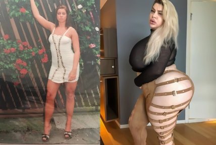 Наташа Краун до та після пластики