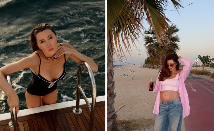 Анна Заворотнюк фото