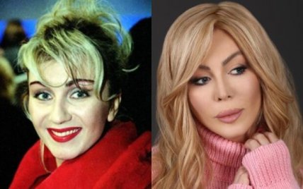 Ирина Билык до пластики