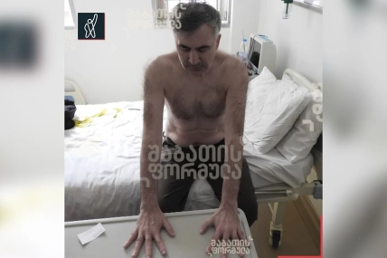Худой мужчина сидит на кровати в больничной палате, опираясь руками на столик