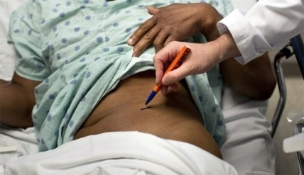 Продать свою почку