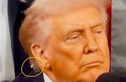 Дивний об'єкт на потилиці Трампа